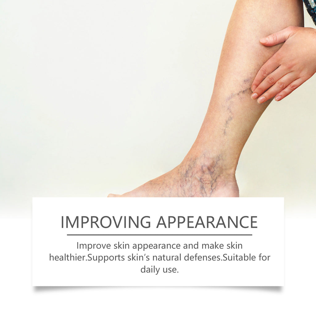 Leg Care Spray for Daily Relief of Leg Varicosity